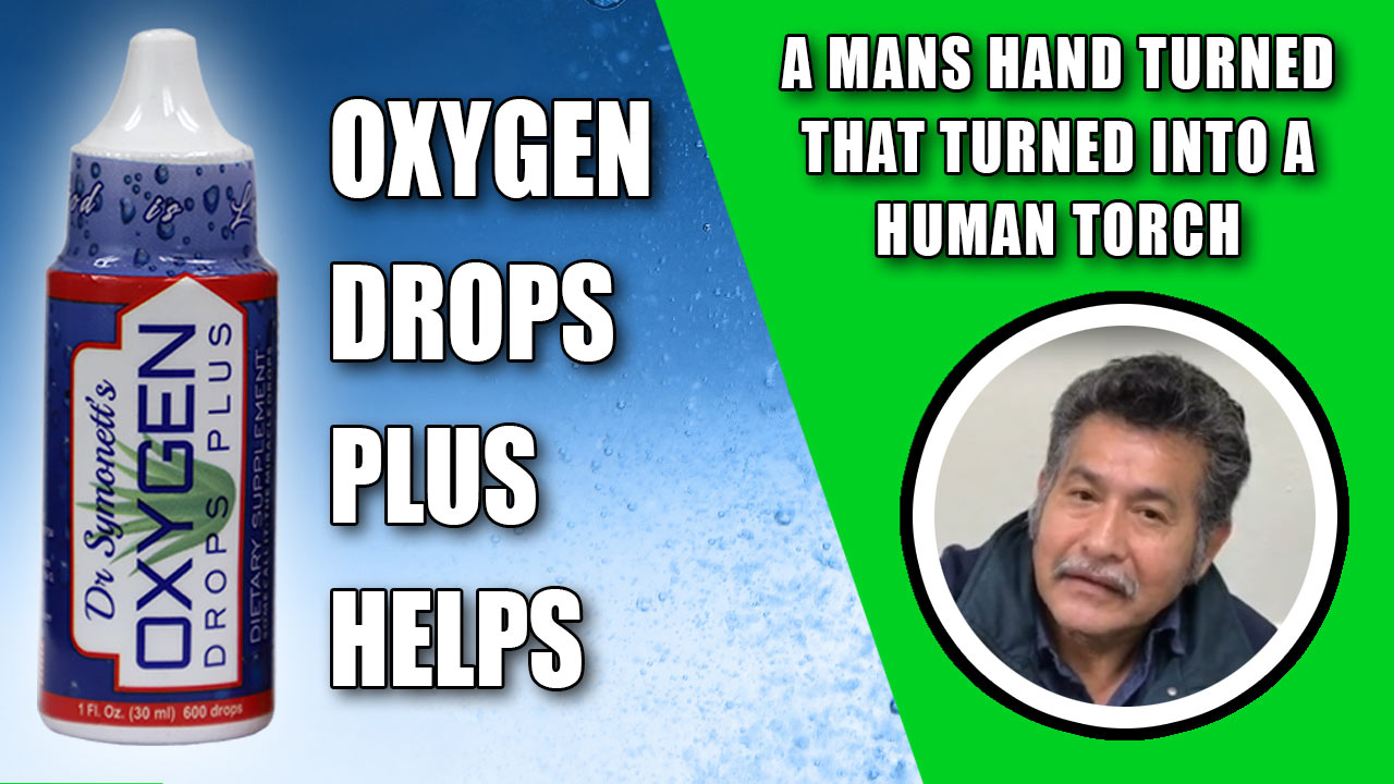 Patients hand turned into a human torch