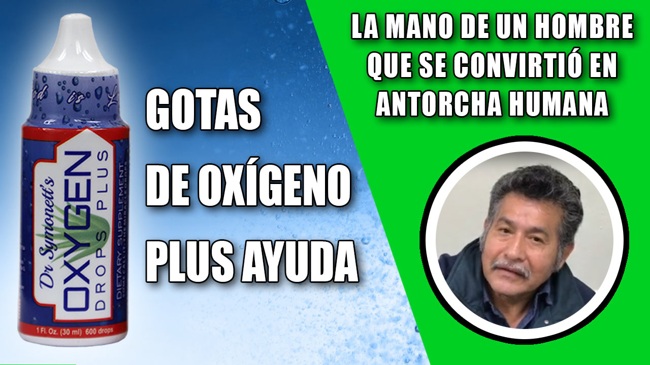 La mano del paciente se convirtió en una antorcha humana